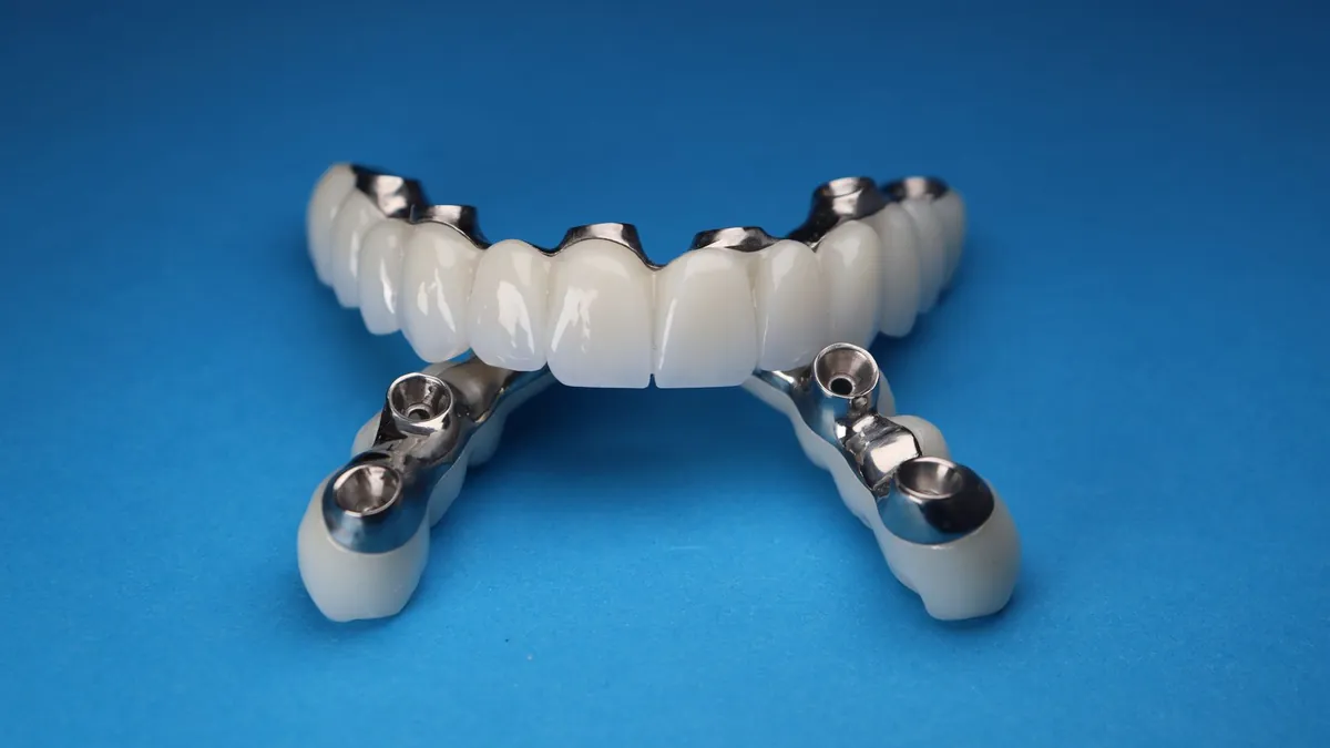 Modèle d'arcade complète sur implants dentaires
