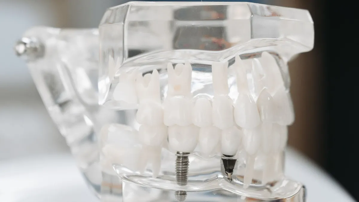 Modèle de mâchoire avec implants dentaires