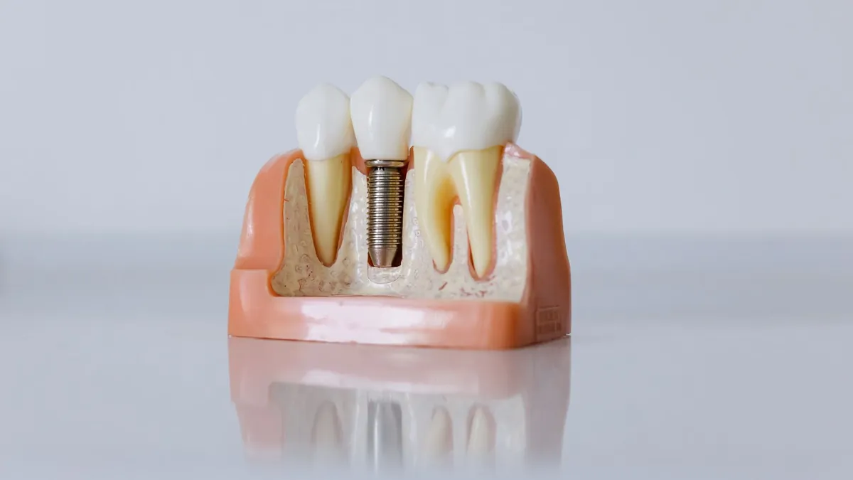 Implant dentaire en titane