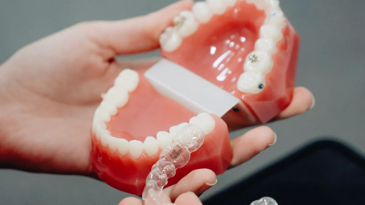 Aligneur invisible type Invisalign