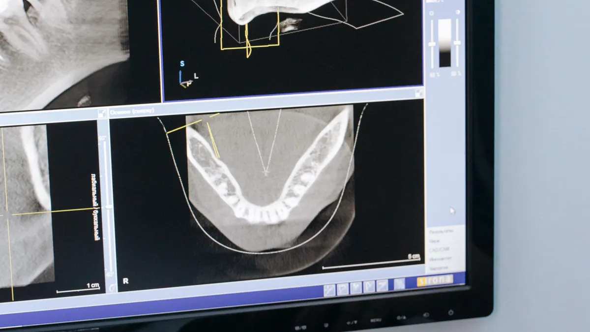 Radiographie panoramique dentaire