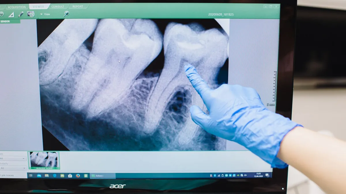 Radiographie d'une racine dentaire