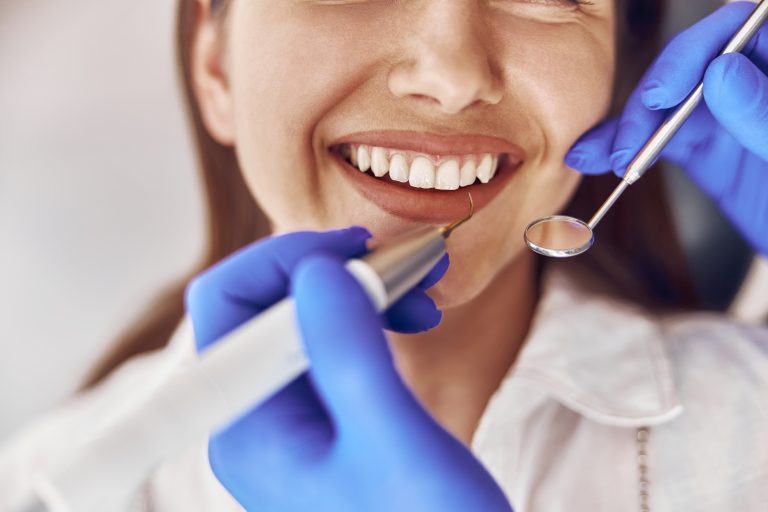 Pourquoi un nettoyage dentaire professionnel est essentiel