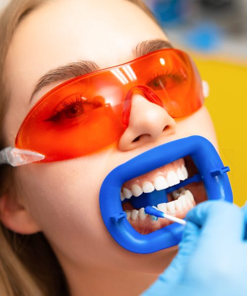 Dentist applies dental plaque gel detector to young woman patient in orange protective goggles teeth in dental clinic.